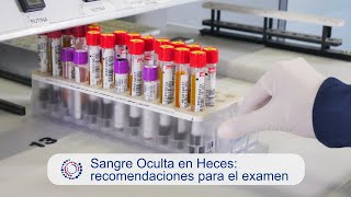 Sangre Oculta en Heces recomendaciones para el examen [upl. by Koffler574]