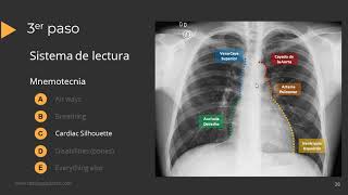 Tutorial Radiografía de Torax [upl. by Asirehc]