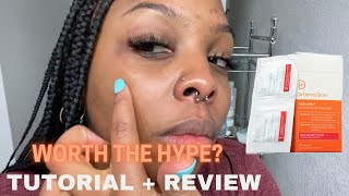 Dr Dennis Gross Daily Peel Review  Tutorial  Skin Routine [upl. by Lindi983]