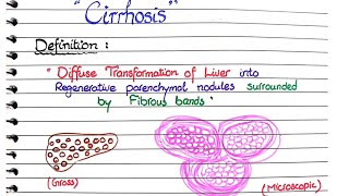 Cirrhosis of Liver  Pathology [upl. by Akinuahs]