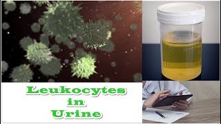 Leukocytes in Urine  No Nitrates [upl. by Bendix]