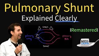 Shunting Explained Clearly Pulmonary Shunt  Remastered [upl. by Ahrendt]