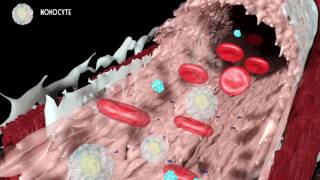 Development of atherosclerosis [upl. by Mathia]