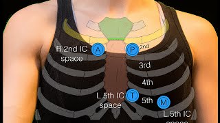 Sternal angle [upl. by Adnyc]