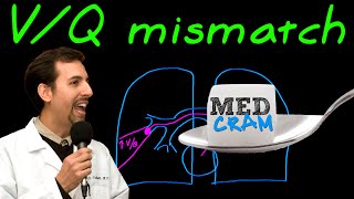 Ventilation Perfusion VQ Mismatch Explained Clearly [upl. by Starlin]