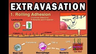 EXTRAVASATION [upl. by Yrmac]