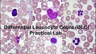 Differential Leucocyte Count DLC Practical Lab [upl. by Had]