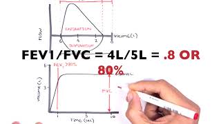 Understanding Spirometry  Normal Obstructive vs Restrictive [upl. by Allehc]