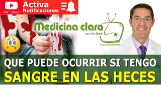 Sangre en las heces sangre con la deposición Enfermedades asociadas  Medicina Clara [upl. by Aruol]