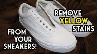 How To Remove Yellow Stains From Your Sneakers  The SIMPLEST and MOST EFFECTIVE Way [upl. by Enelym]